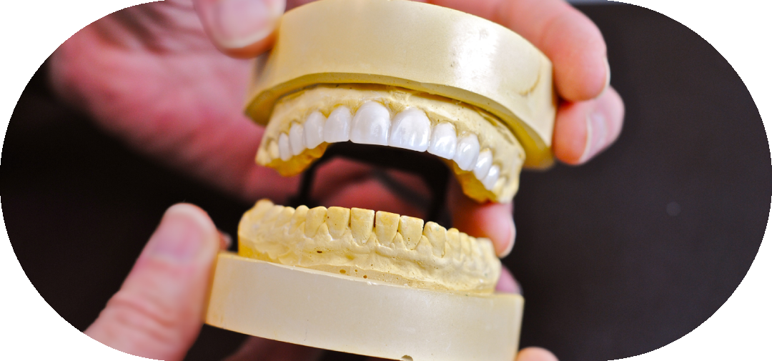 CAD/CAM моделирование зубов